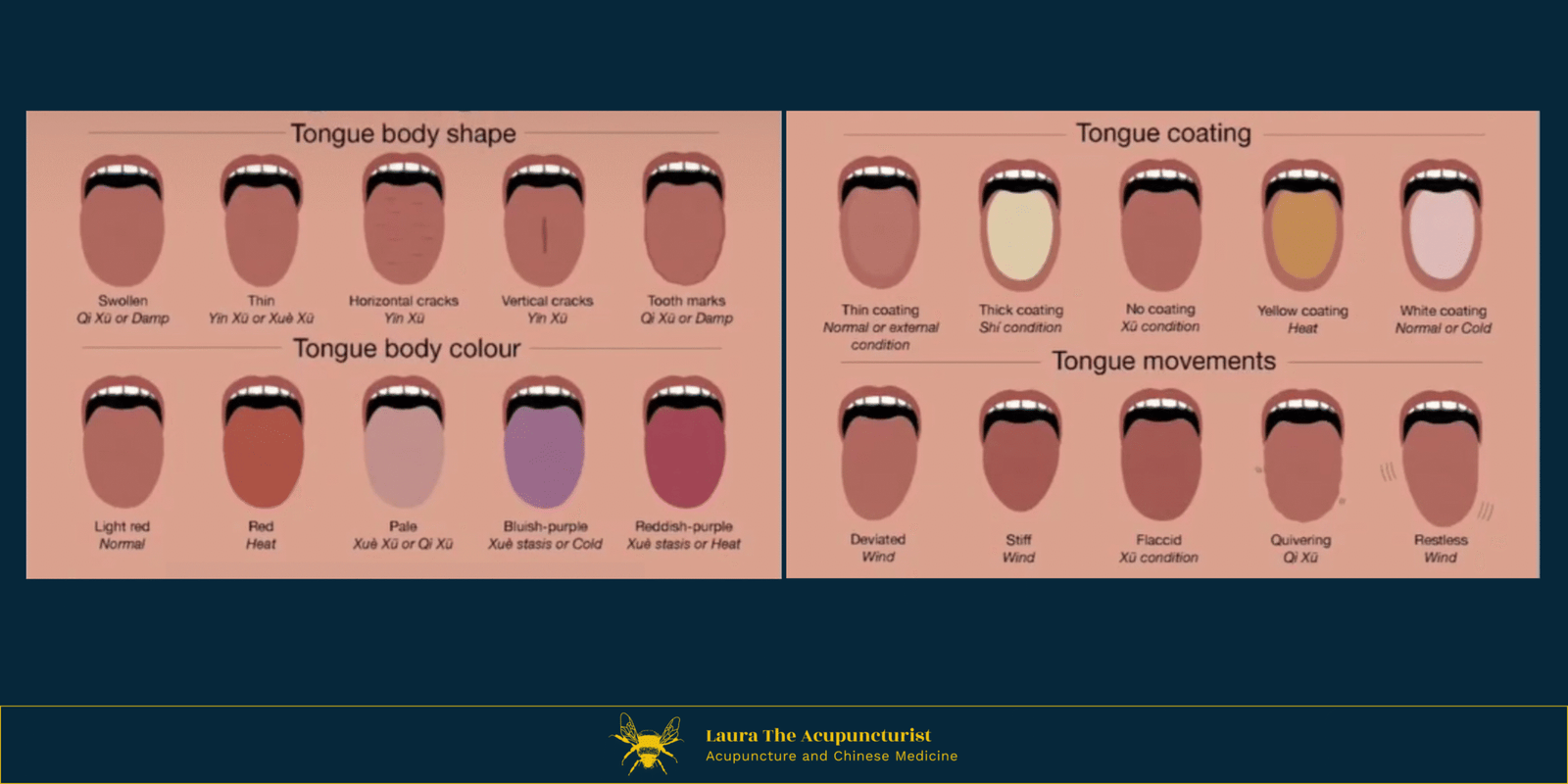 Use TCM Tongue Diagnosis To Understand Your Health