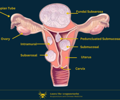 Fibroids