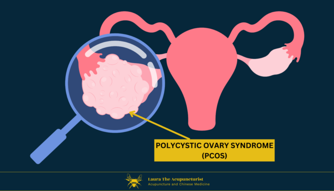 PCOS