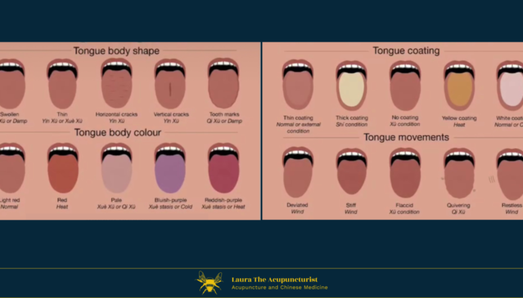 Tongue Diagnosis