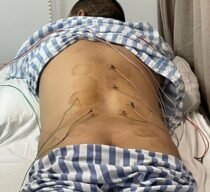 Back treatment